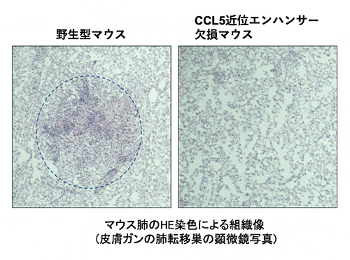 CCL5近位エンハンサー欠損マウスは野生型マウスと比較してがん転移巣の形成が抑制されたの図