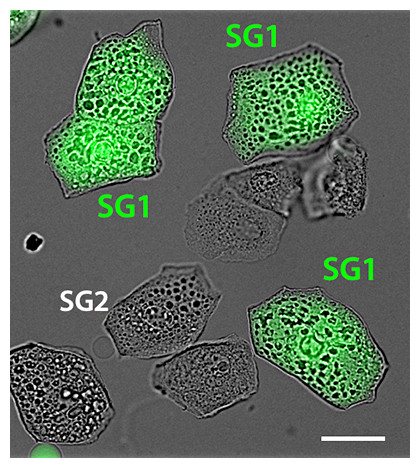 分離したマウス顆粒層SG1細胞の顕微鏡画像の図