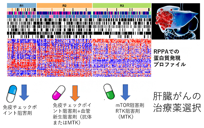 肝臓がんの三つの機能的タンパク質発現に基づく分類（R1、R2、R3）と最適な治療薬の図